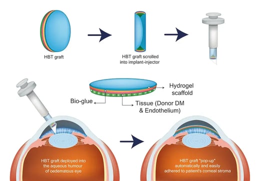 HYGELIX_schematic