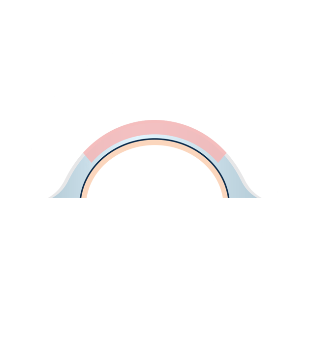 Anterior Lamellar Keratoplasty